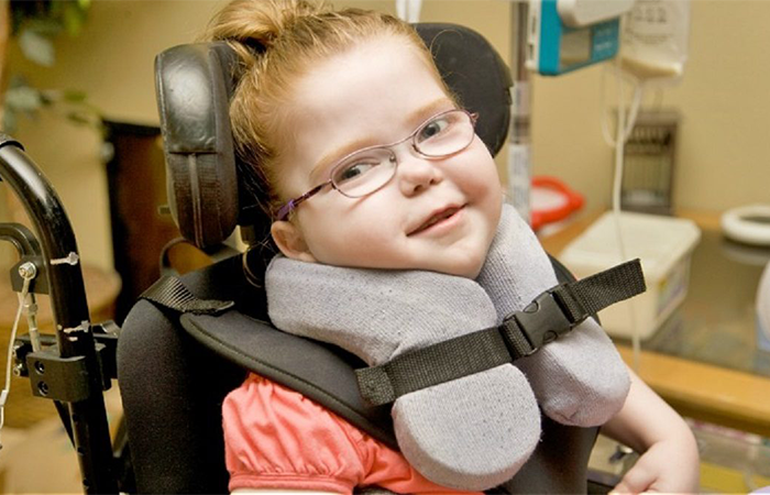 معلولیت جسمی حرکتی